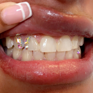 Tooth Gem Diamond Training Amsterdam